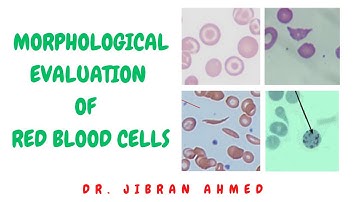 MORPHOLOGICAL EVALUATION OF RED BLOOD CELLS  II PRACTICAL PATHOLOGY II  @DR. JIBRAN AHMED