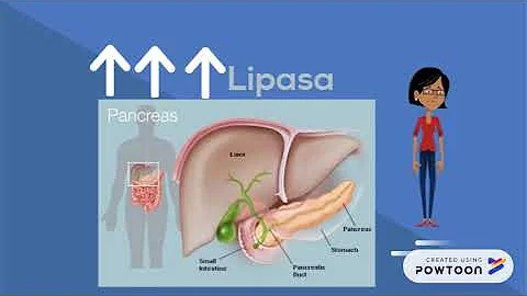 ¿Una lipasa alta significa diabetes?