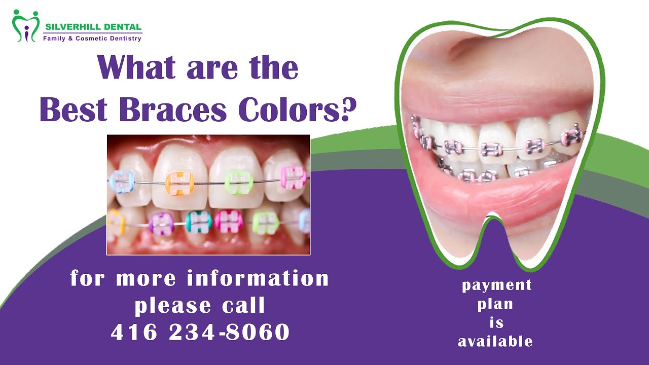 clear braces with purple bands