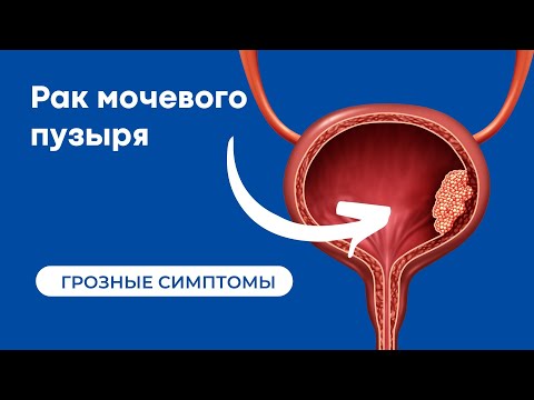 Видео: Является ли кровотечение признаком рака мочевого пузыря?