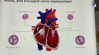 Life-saving techniques & materials – Saint-Gobain Medical