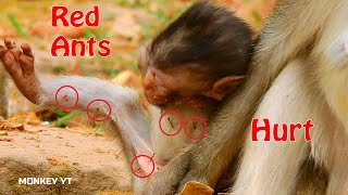 Pitiful Million Red Ants Bites Baby Alba Cry Seizure, Alba Need Mom Help Remove Its On Skin