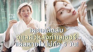 เคล็ดลับดูแลผิวหน้าหลังทำเลเซอร์ ไม่ถึง 5 วัน แผลหาย! | Bryan Tan