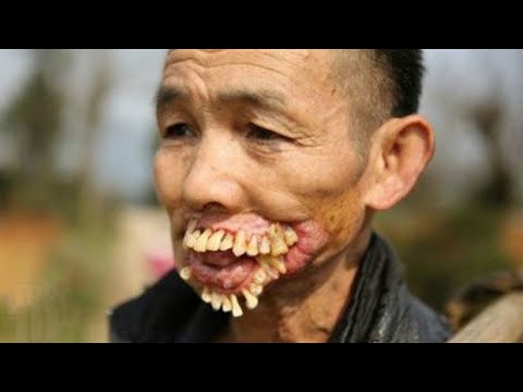 10 Scariest Diseases in the World