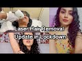 LASER HAIR REMOVAL UPDATE AFTER 6 MONTHS | Hair Removal in Lockdown |Laser Hair Removal Works or Not