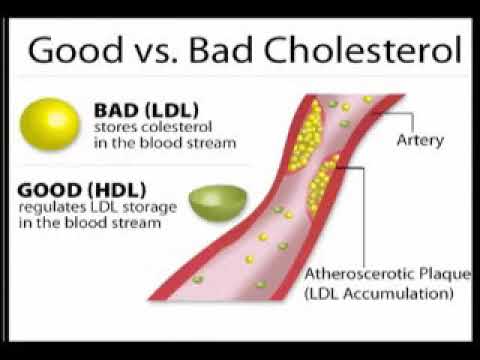 Valor del colesterol ldl