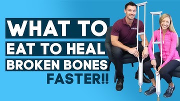 Broken Bones Diet - What to Eat to Heal Broken Bones Faster (Food for Bones)