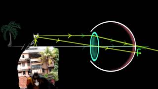 Human eye: accommodation and near point (Hindi) | Human eye | Physics | Khan Academy