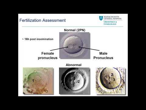 Video: Aromatasehemmere I Stimulerte IVF-sykluser