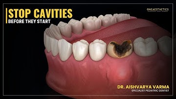 STOP Cavities Before They Start | Dentist Explains How to Protect Your Teeth 🦷 | Dr. Aishvarya Varma