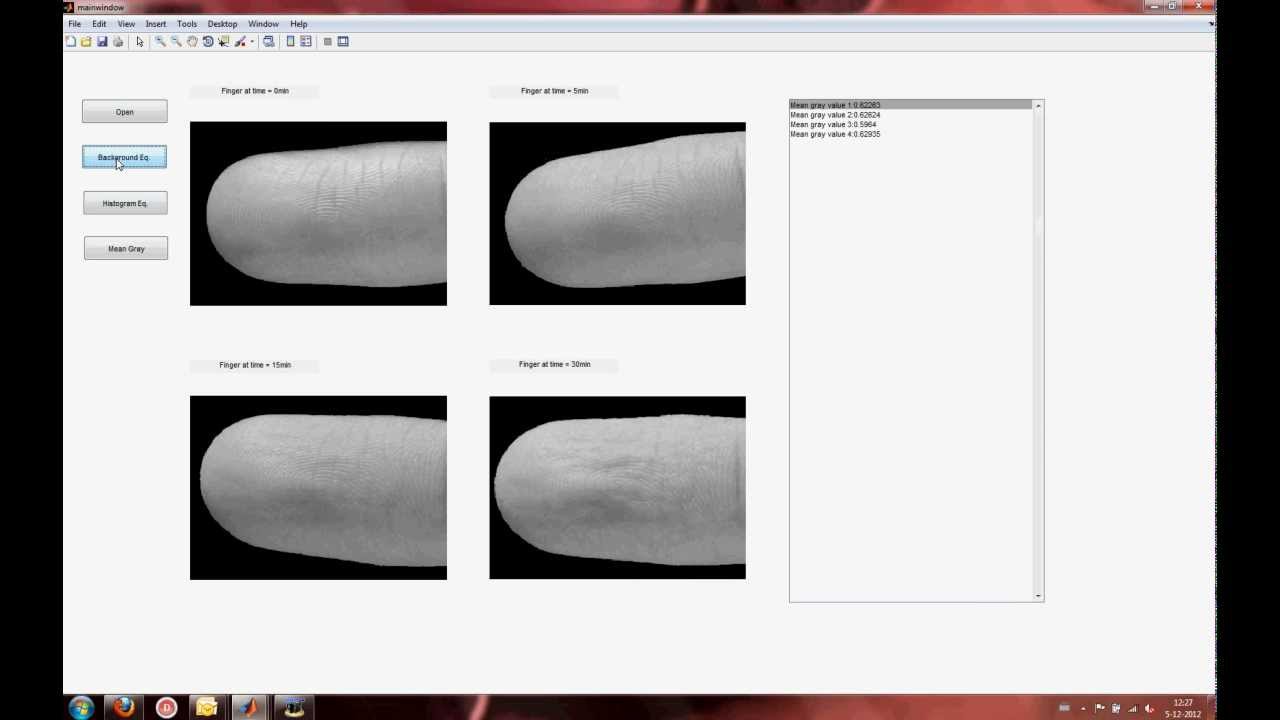 TU/e ME - Neurology Assignment - Finger detection program Beta preview ...