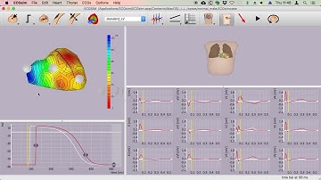 Some simple applications of ECGsim