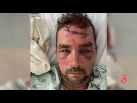 Cubano venezolano es atacado brutalmente por dos ladrones a las afueras de su negocio en Hialeah