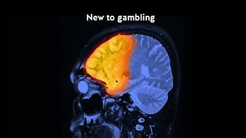 How the brain changes with gambling - 30secs