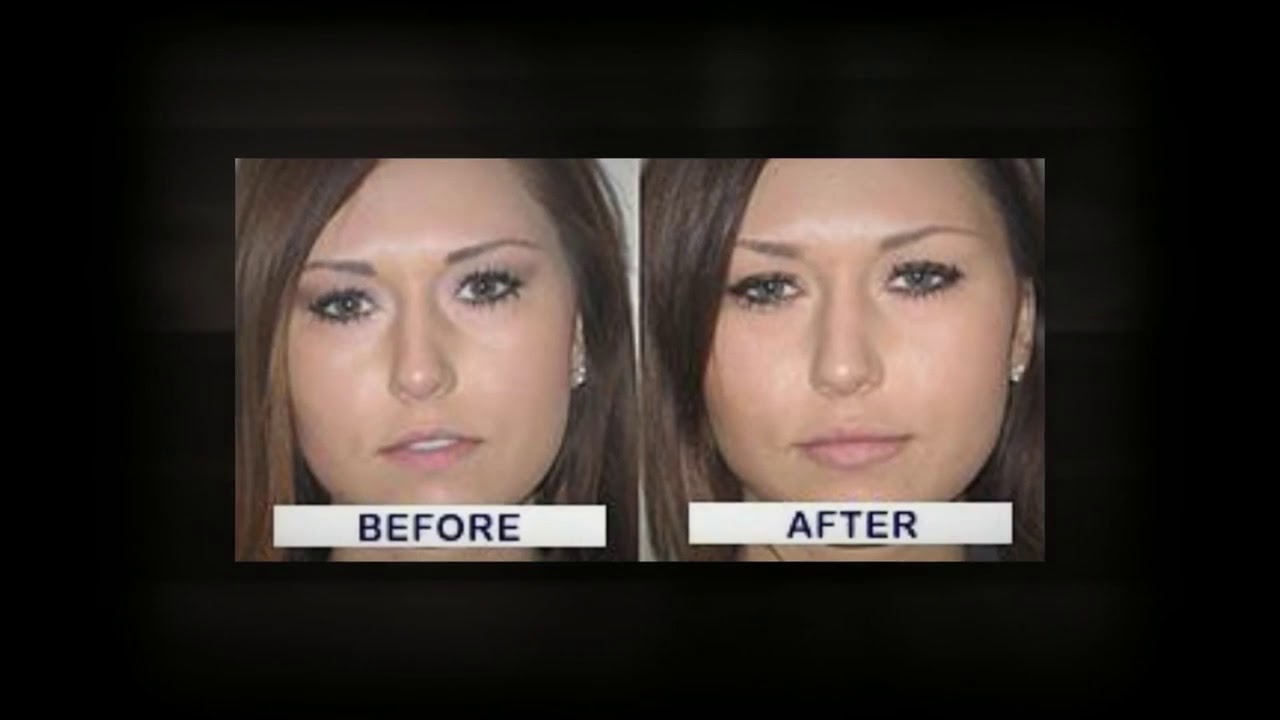 Idol Lips   Does Idol Lips Work