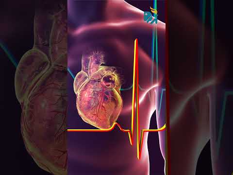 Open Heart Surgery vs Bypass Surgery