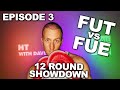 HT FAQ: FUT vs FUE Hair Transplant Battle – Epic 12 ROUND SHOWDOWN Comparison + 4-Week Update