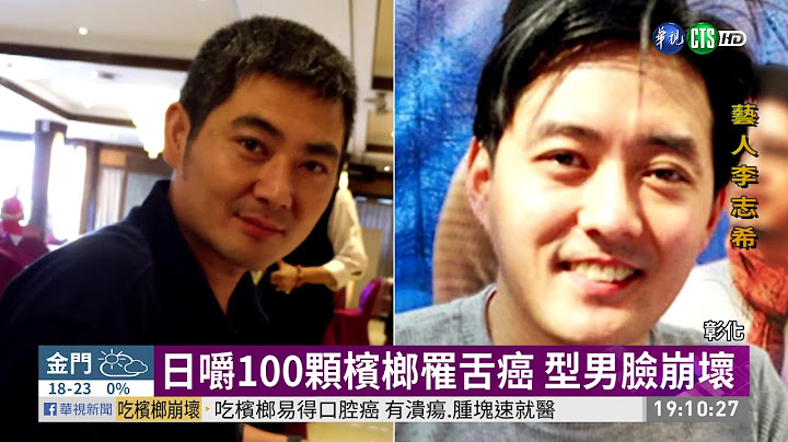 日嚼100顆檳榔罹舌癌 型男臉崩壞 | 華視新聞 20191126 - 天天要聞