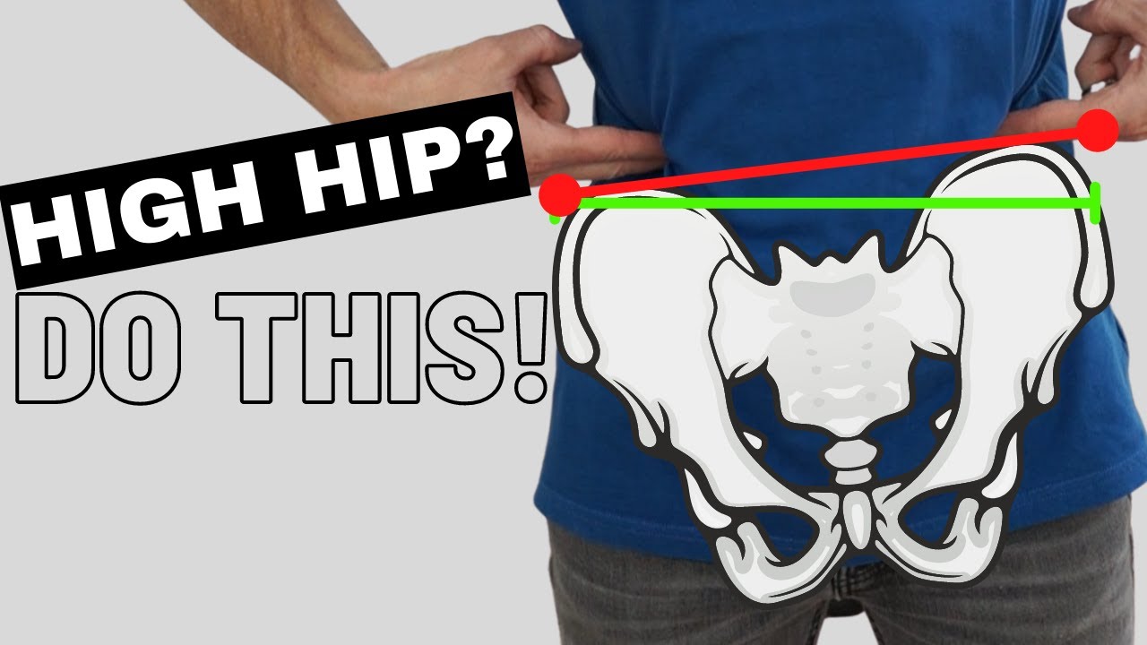How To Self Correct (FIX) a High Hip (Uneven Pelvis) 