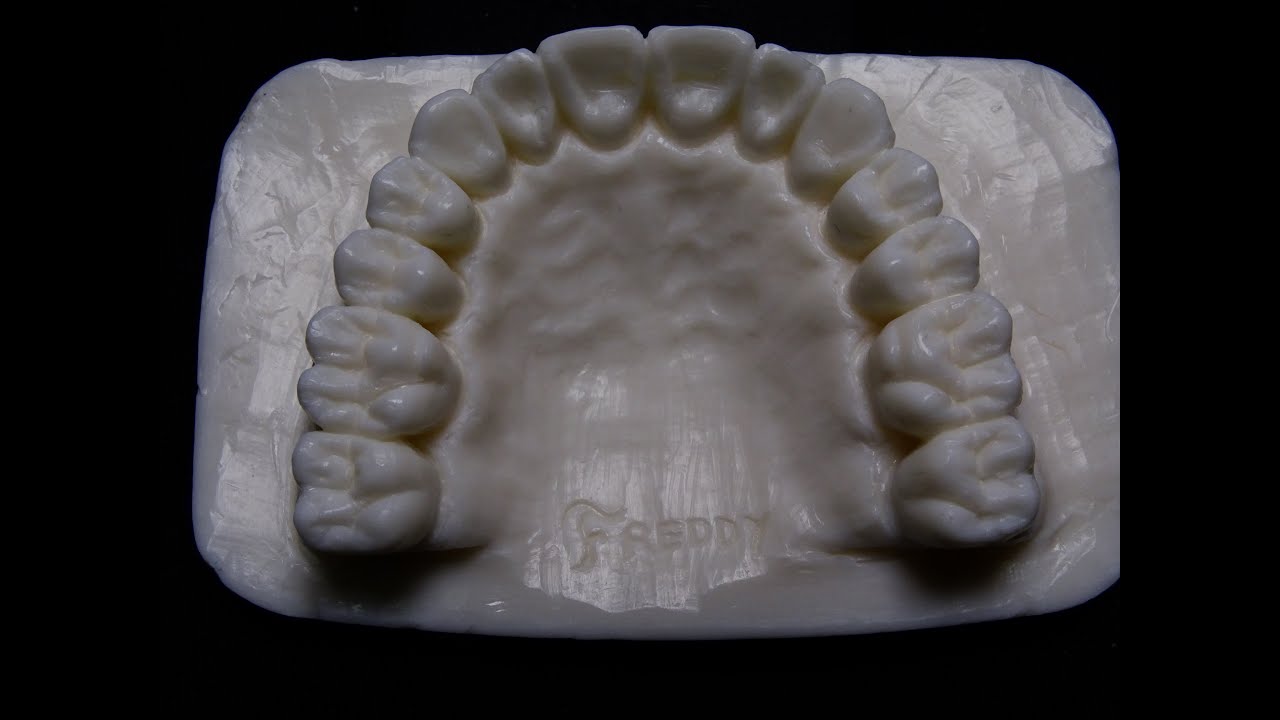 TALLADO EN JABON MAXILAR SUPERIOR