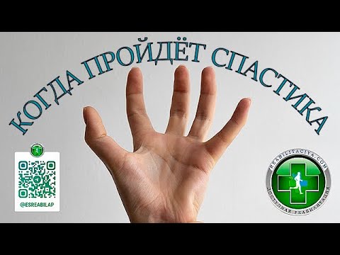 Когда пройдет спастика после инсульта.