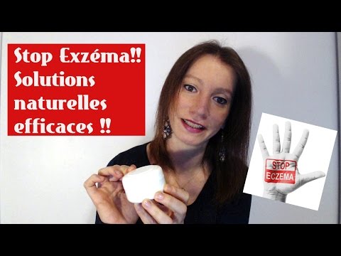 Stop eczéma !!! Solutions naturelles efficaces et DIY recette baume maison ! 😉