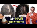 DIY HAIR TREATMENT ,GET  HEALTHY SILKY AND SMOOTH HAIR - Dr. Vivek Joshi