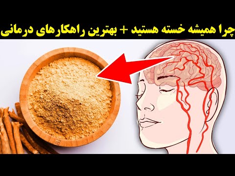 تصویری: 3 راه برای تشخیص علائم سندرم خستگی مزمن