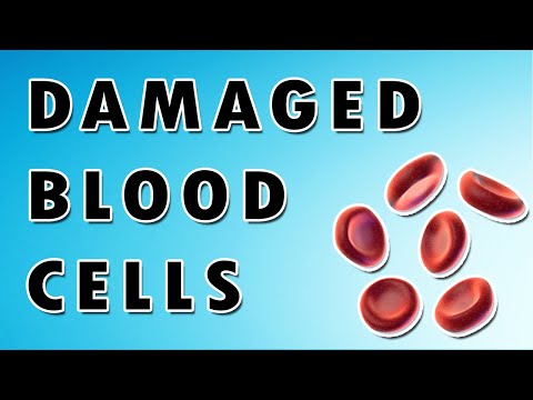 Spherocytes, Acanthocytes, and Schistocytes - RBC Changes and Pathologies