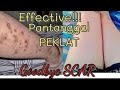 Paano Mawala Ang PEKLAT | Effective Pantanggal Ng PEKLAT | Scar Remover | 💯√