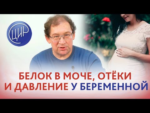 Преэклампсия: белок в моче, давление и отёки при беременности. Тактика ведения. Гузов И.И.