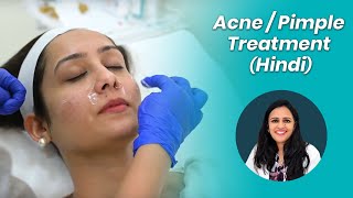 Acne Treatment (Hindi)  पिम्पल्स को कैसे रोके