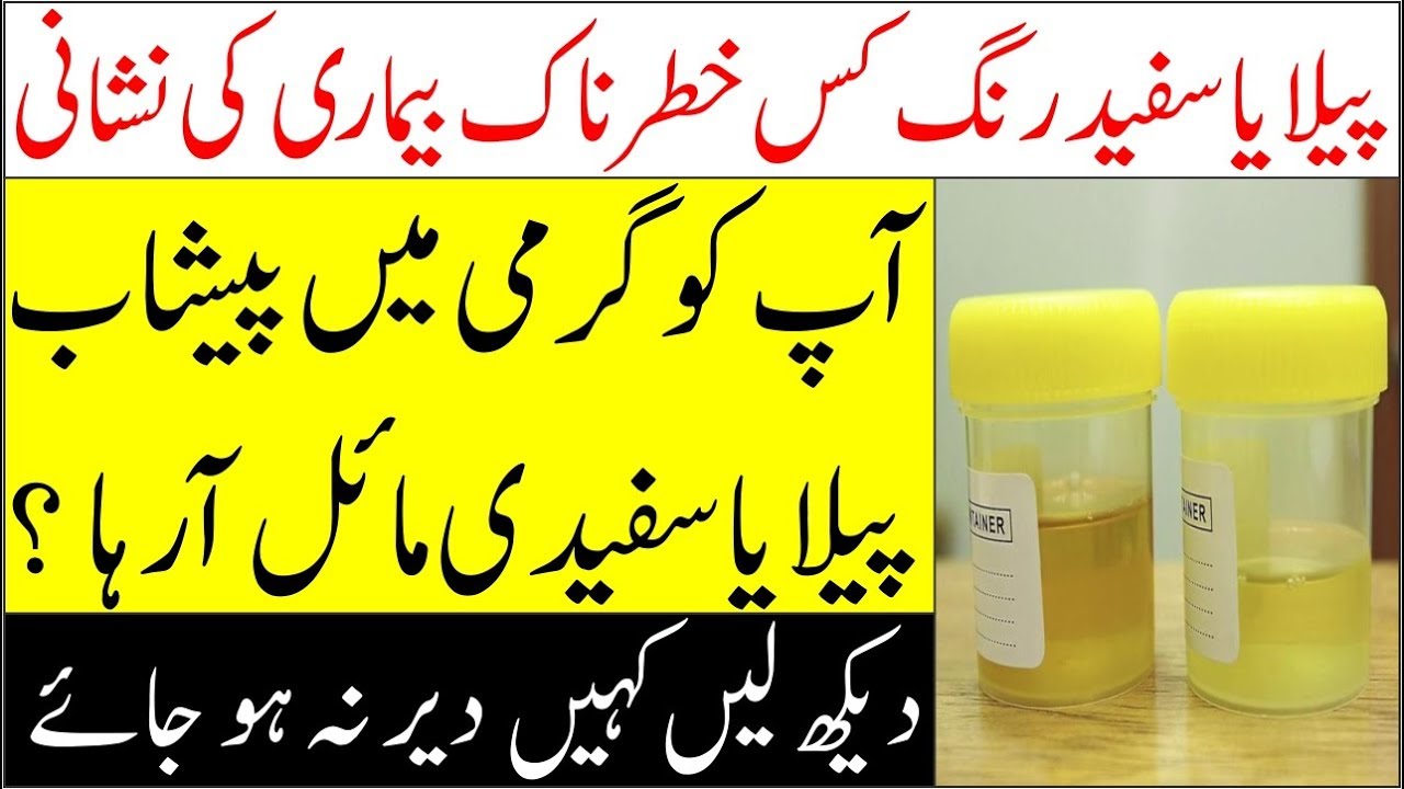 What Does The Color Of Urine Suggest II Paishab Peela Ya Safaid Rung what-does-the-color-of-urine-suggest-ii-paishab-peela-ya-safaid-rung