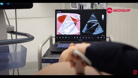 Mediquip Simulation: Elevate Vimedix Ultrasound Simulators