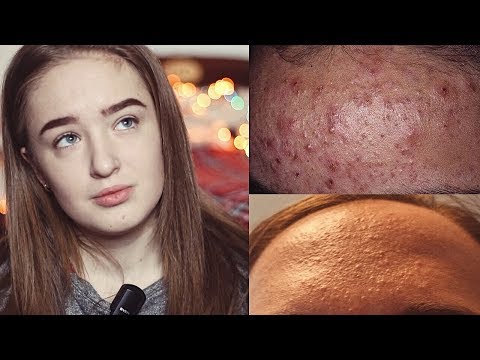 Как избавиться от прежнего
