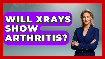 Will XRAYS Show Arthritis? - Orthopedic Support Network