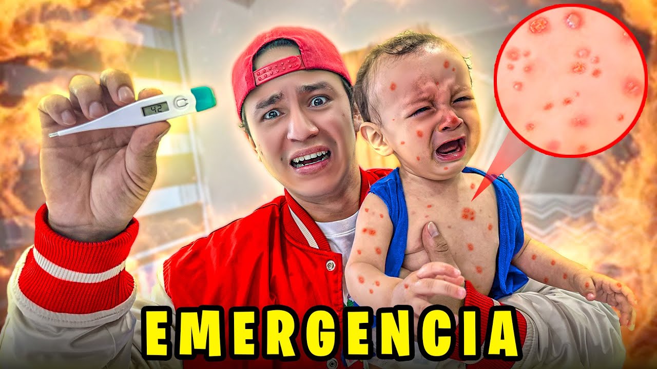 ¡MI HIJO TIENE VARICELA! * Esta muy ENFERMO 🚑