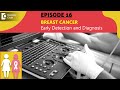 Tests To Detect Breast Cancer Early & When To Start?|Dr. Sandeep Nayak | Samrohana | Doctors