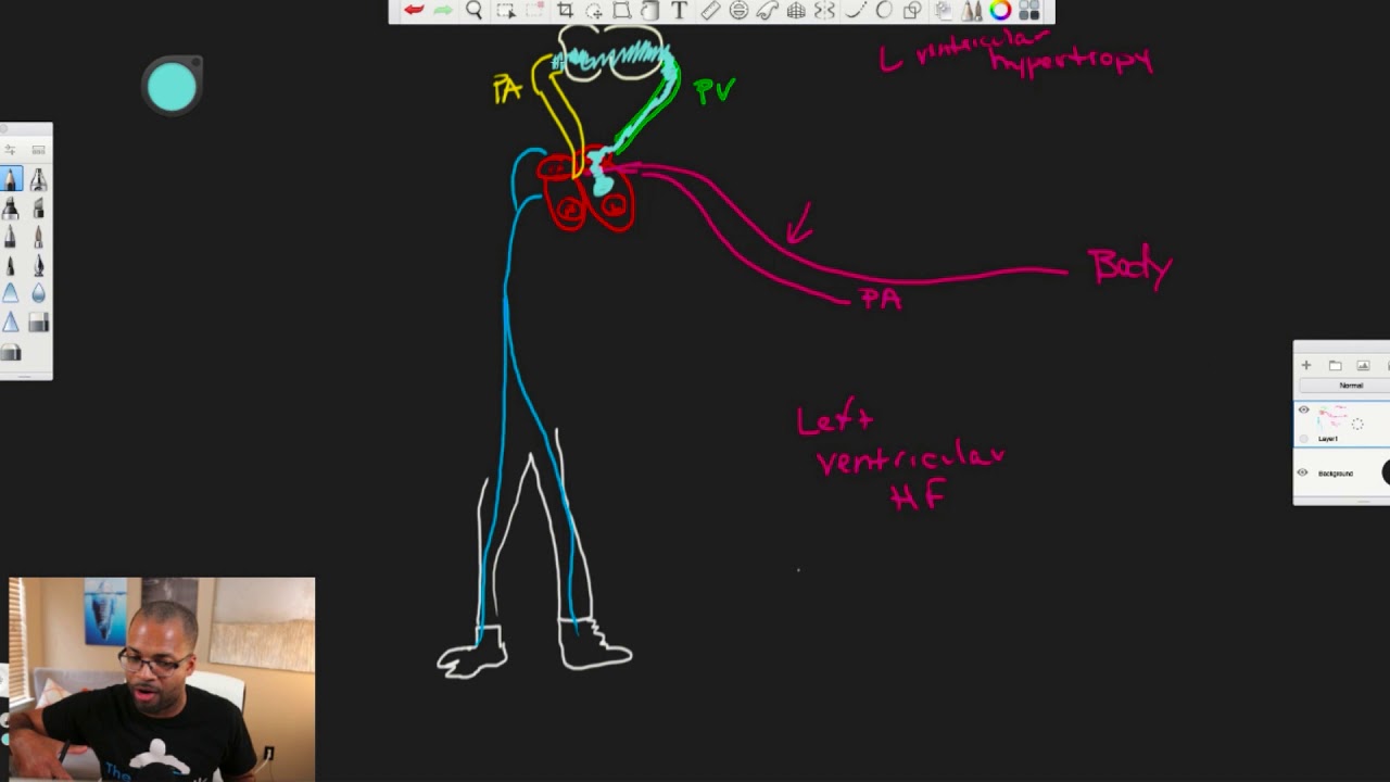 Understanding Congestive Heart Failure