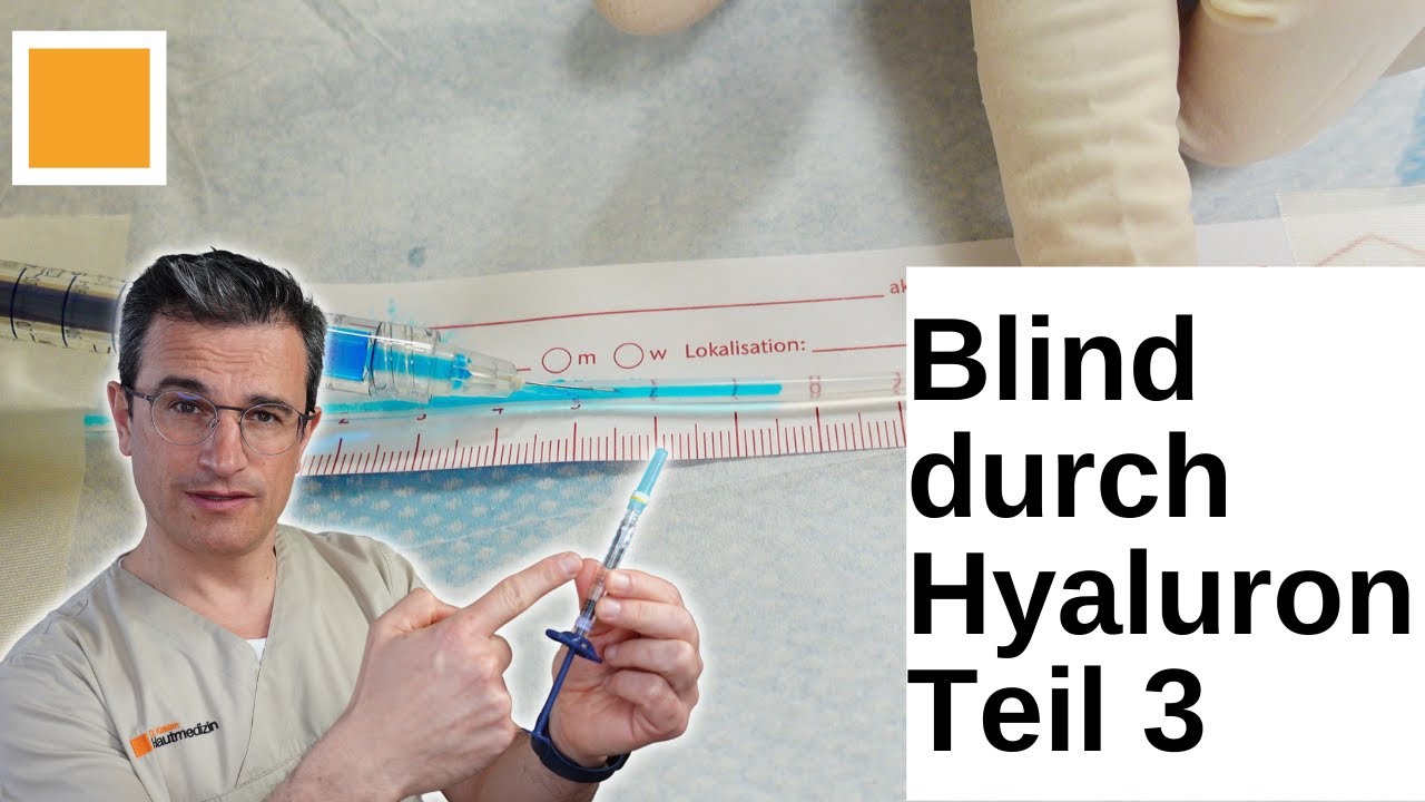 Rezensionen Für Dr. Kasten - Hautmedizin Erblindung nach Hyaluronfillern Teil 3. Dr. Kasten Hautmedizin in Mainz