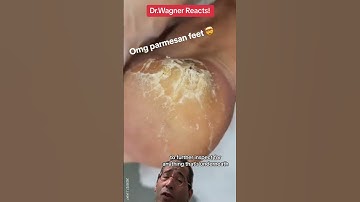 SHAVING CALLUS SLABS🧀#shorts