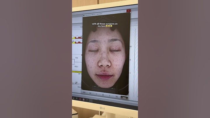 my first skin treatment in Korea #kbeauty #korea #seoul #beautytreatment