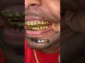 14TOP 14BOTTOM Dental Gold 24K🏠🏠🏠Picked Up At Our Jacksonville Florida Location‼️ Glee Grillz 14TOP 14BOTTOM Dental Gold 24K🏠🏠🏠Picked Up At Our Jacksonville Florida Location‼️ Glee Grillz