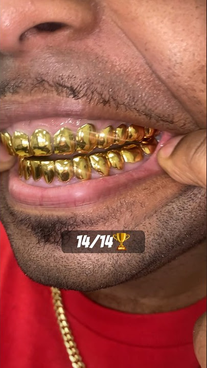 Download lagu 14TOP 14BOTTOM Dental Gold 24K🏆🏆🏆 picked up at our Jacksonville Florida location‼️ #glee #grillz