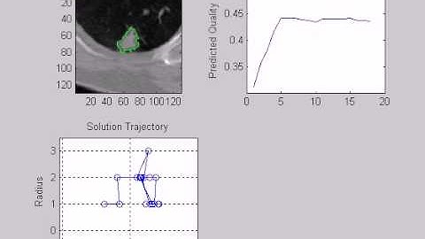 Segmentation of Pulmonary Nodules in CT Using a Regression NN Approach