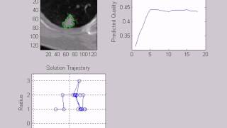 Celebrity Segmentation of Pulmonary Nodules in CT Using a Regression NN Approach Wealth