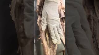 Posterior and lateral compartment of leg #muscles #nerve #artery #back of leg