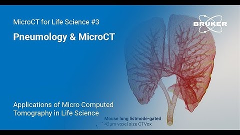 Pneumology & MicroCT | Applications of MicroCT in Life Science #3