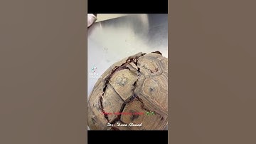Thumbnail of Broken tortoise shell 😢 #shorts #usa