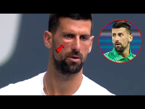 Novak Djokovic's Painful Eye Injury Stuns Fans—Miami Open Chaos! - YouTube